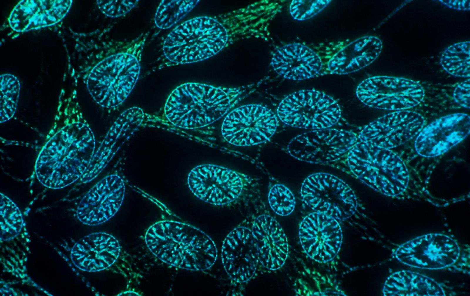 Mitochondrial imaging from a research setting.